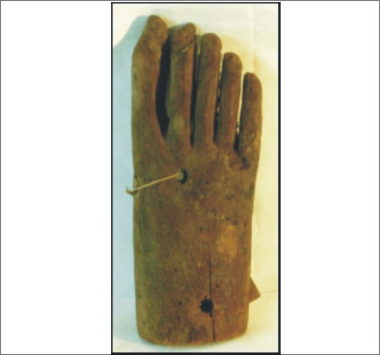 Image for: Foot, likely from a coffin